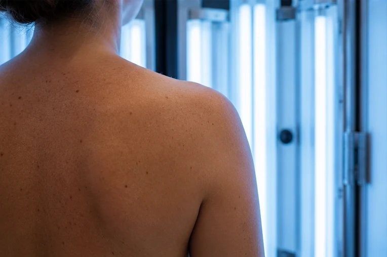 Patient standing in a phototherapy unit