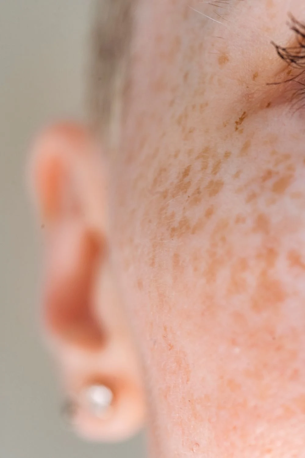 Close-up of natural cheek skin with visible texture and freckles